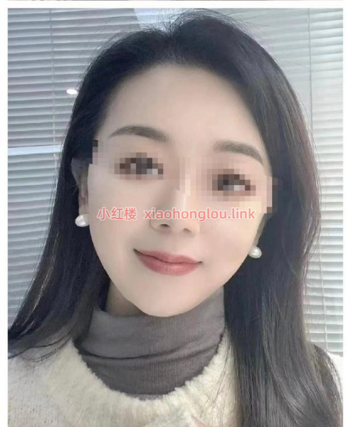 2025032920410431119.png